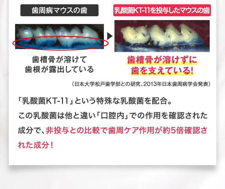 「乳酸菌KT-11」という特殊な乳酸菌を配合。
この乳酸菌は他と違い「口腔内」での作用を確認された成分で、非投与との比較で歯周ケア作用が約5倍確認された成分！